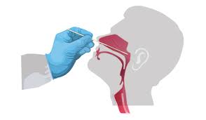 COVID-19 Nasal Swab Test Market Trends Driven by Rising Demand