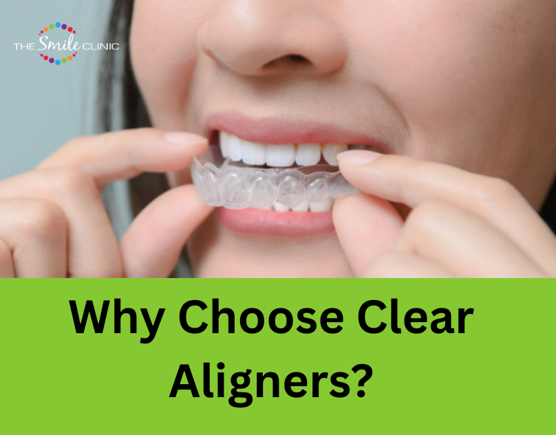 Clear Aligners in Colchester 每 Discreet, Custom Treatment at The Smile Clinic