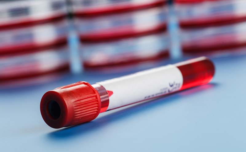 Blood Collection Tubes Market Revenue and Share by Manufacturers Forecast 2021-2030