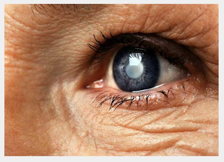 Eye Doctor in Dubai