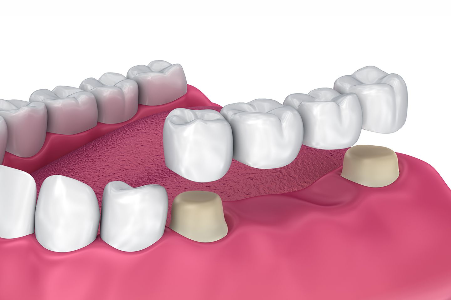 Consider These 4 Elements When Searching for the Best Dental Clinic in Rochester