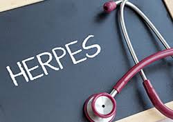 Genital Herpes Market 2020 Major Key Players and Industry Analysis Till 2027