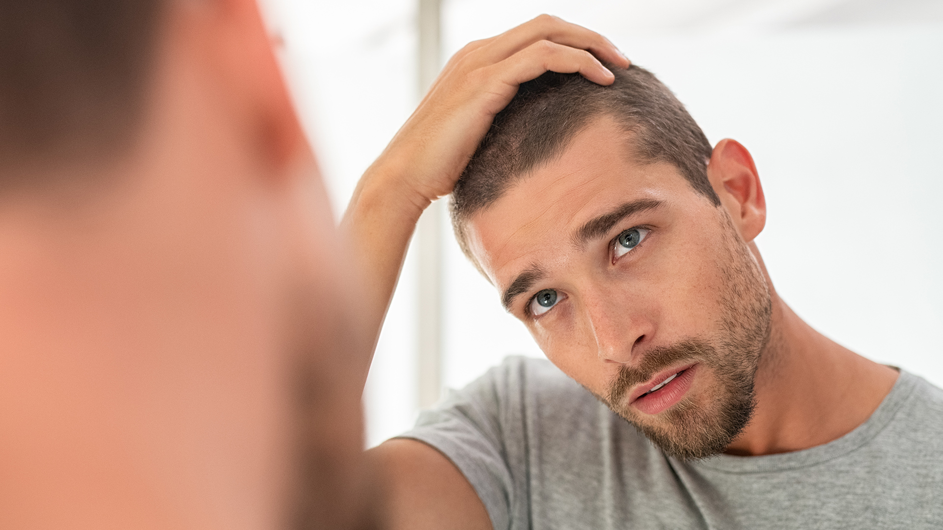 Wie Finasterid in Propecia die Ursache von Haarausfall bekämpft
