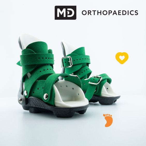 What do you know about Clubfoot Surgery?