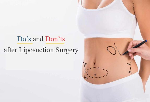 Find the best Liposuction Surgeon in Chennai