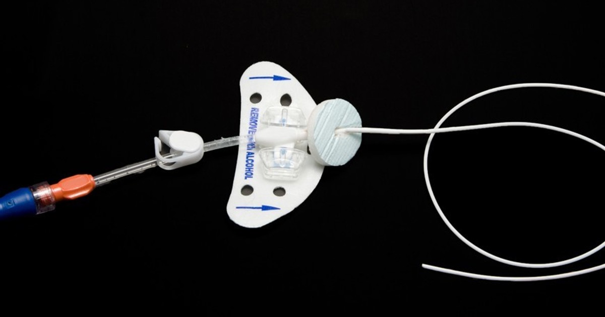 Exploring the Types and Uses of Indwelling Catheters Zupyak