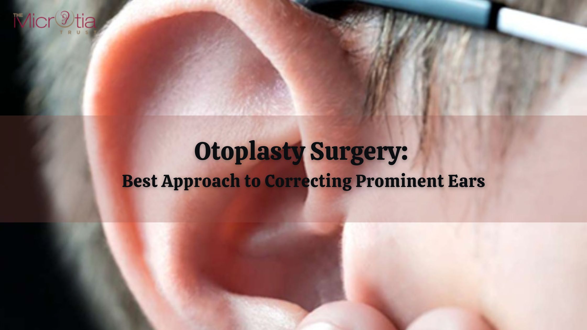 Otoplasty Surgery: Best Approach to Correcting Prominent Ears