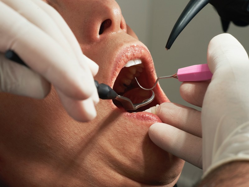 We Provide Comprehensive Dental Care!