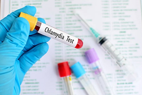 Chlamydia Infection Treatment Market to Witness Steady Growth During The Forecast Period 2027