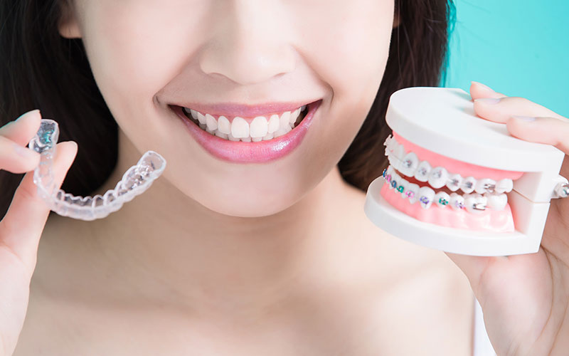 What Are the Benefits of Orthodontic Treatment?