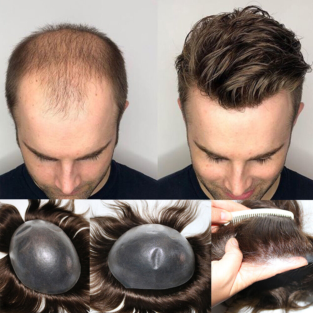 Mens Hair Systems and the Standard of Mens Toupee