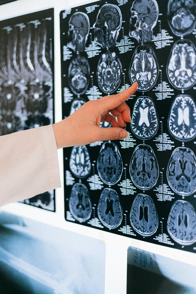 Understanding Traumatic Brain Injury