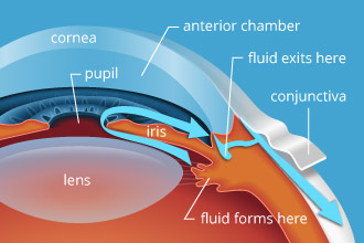 Best Glaucoma Specialist in Kolkata