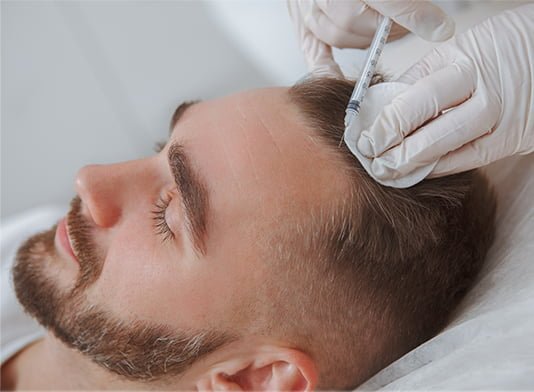What are the benefits of biotin PRP treatment?