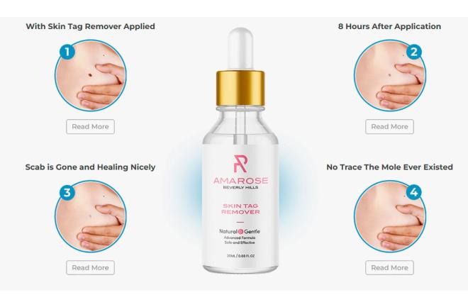 Advantages of Utilizing Amarose Skin Tag Remover USA