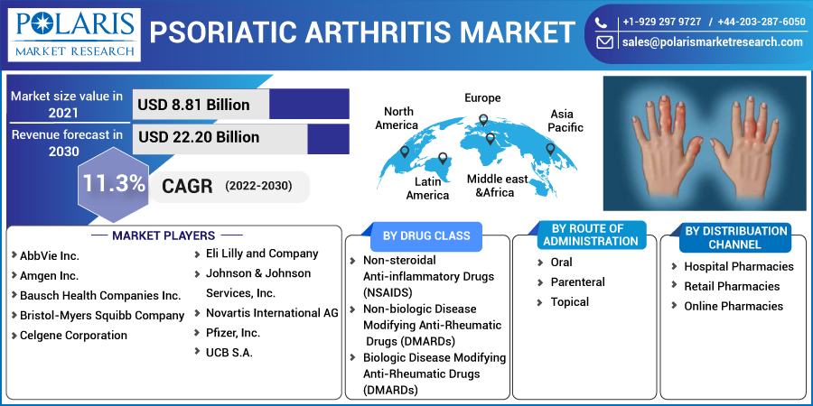 Psoriatic Arthritis Market Size 2023 Statistics, Prospects and Geographical Analysis by Forecast to 2032