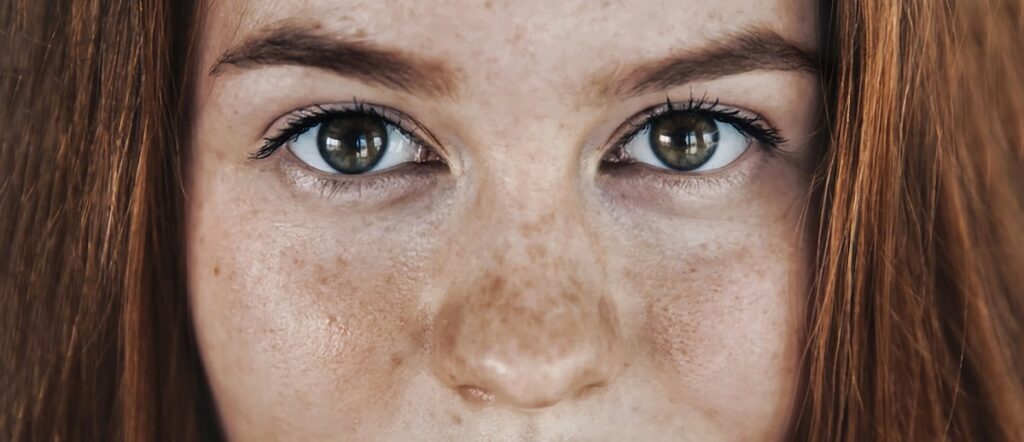 5 Treatments for Skin Pigmentation and Discolouration Problems - Banker Skin & Smile Clinic