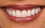 How a Dentist Near Me Can Help with Dental Anxiety