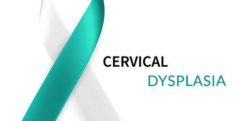 Cervical Dysplasia Market Demand Analysis, Statistics, Industry Trends And Investment Opportunities To 2030