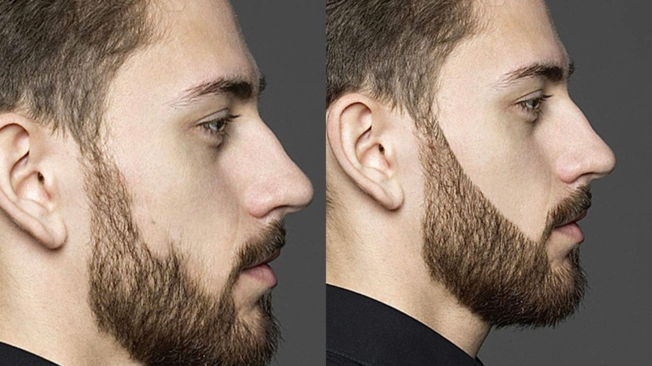 Is Beard Micropigmentation Right for You? Signs to Look for: