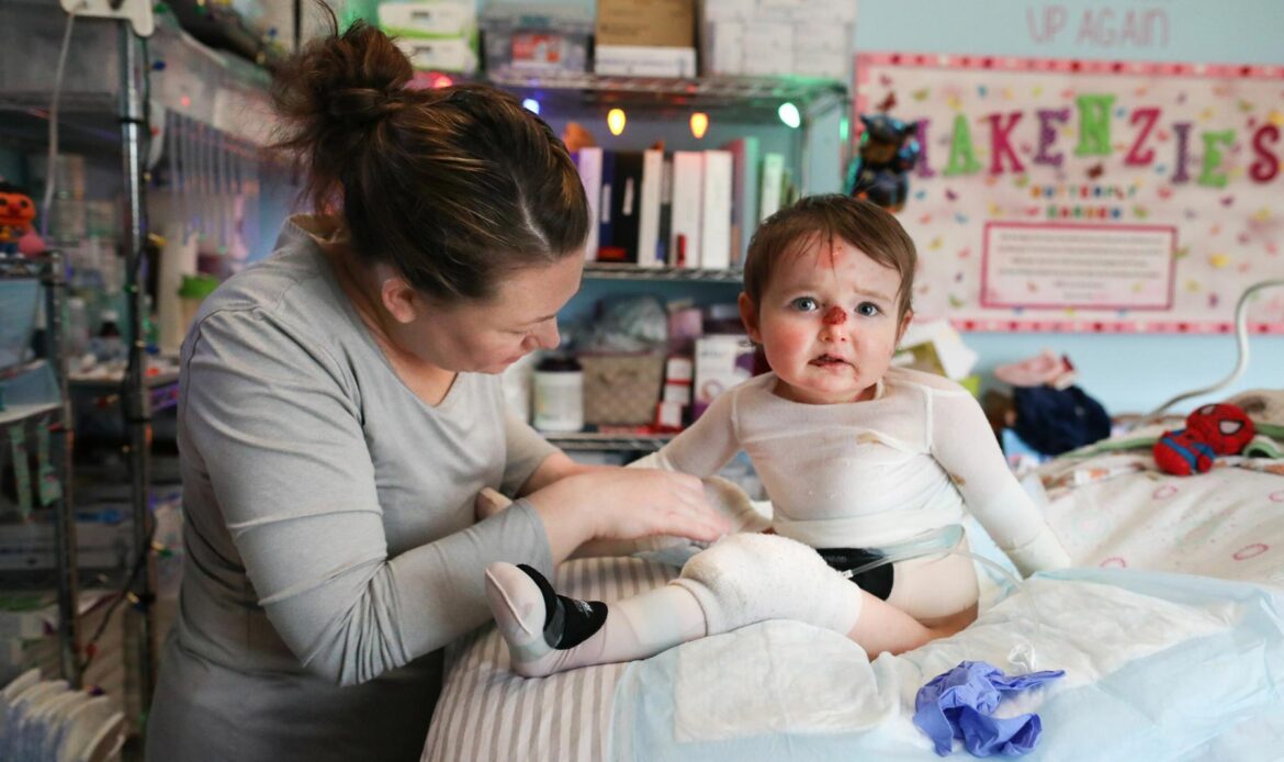 Gene Therapy is fastest growing segment fueling the growth of Epidermolysis Bullosa Market