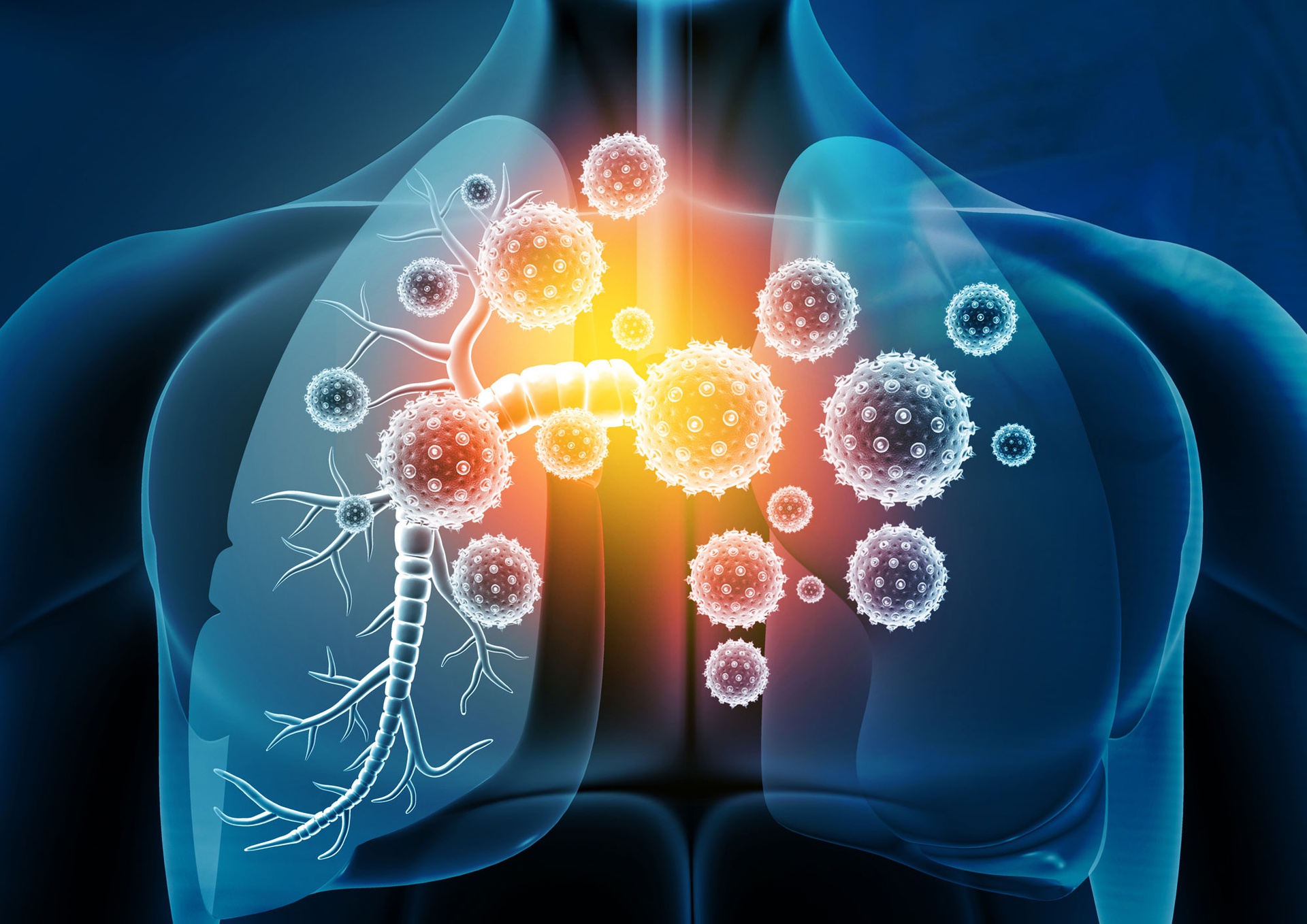 The Global Respiratory Tract Infection Treatment Market Growth Accelerated By Rising Incidence Of Respiratory Tract Infections