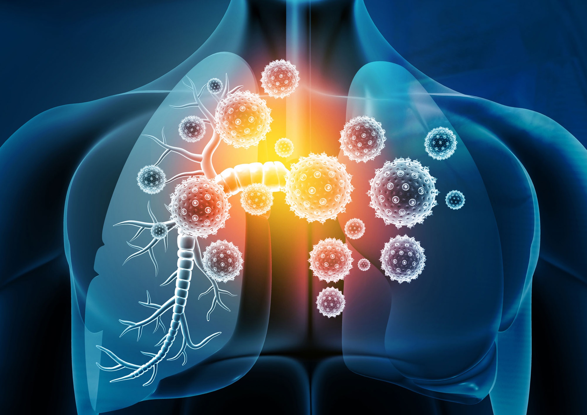  The Global Respiratory Tract Infection Treatment Market Growth Accelerated By Rising Incidence Of Respiratory Tract Infections