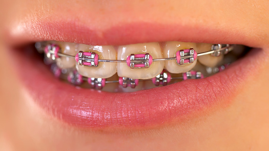 10 Things You Didn't Know About Becoming an Orthodontist