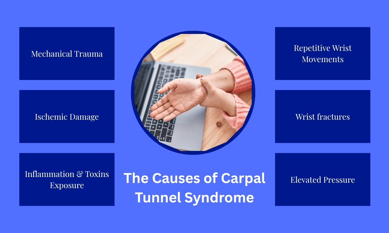 Carpal Tunnel Syndrome Causes You May Not Realize Are Hurting You