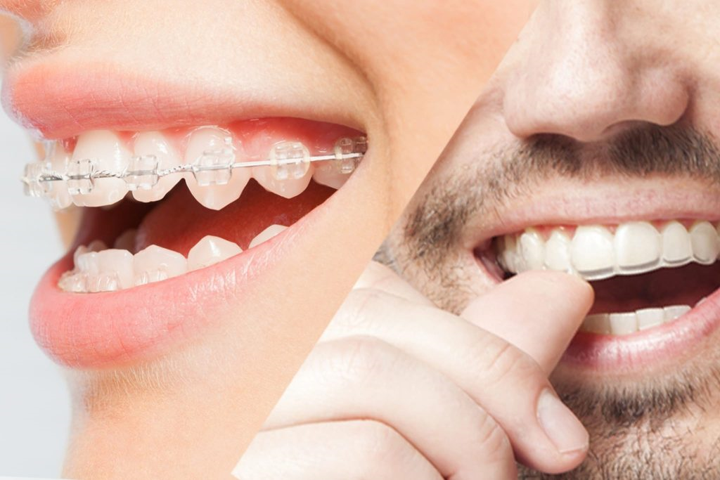 Chapel Street Dental¡¯s 7 Secrets to Perfect Oral Health
