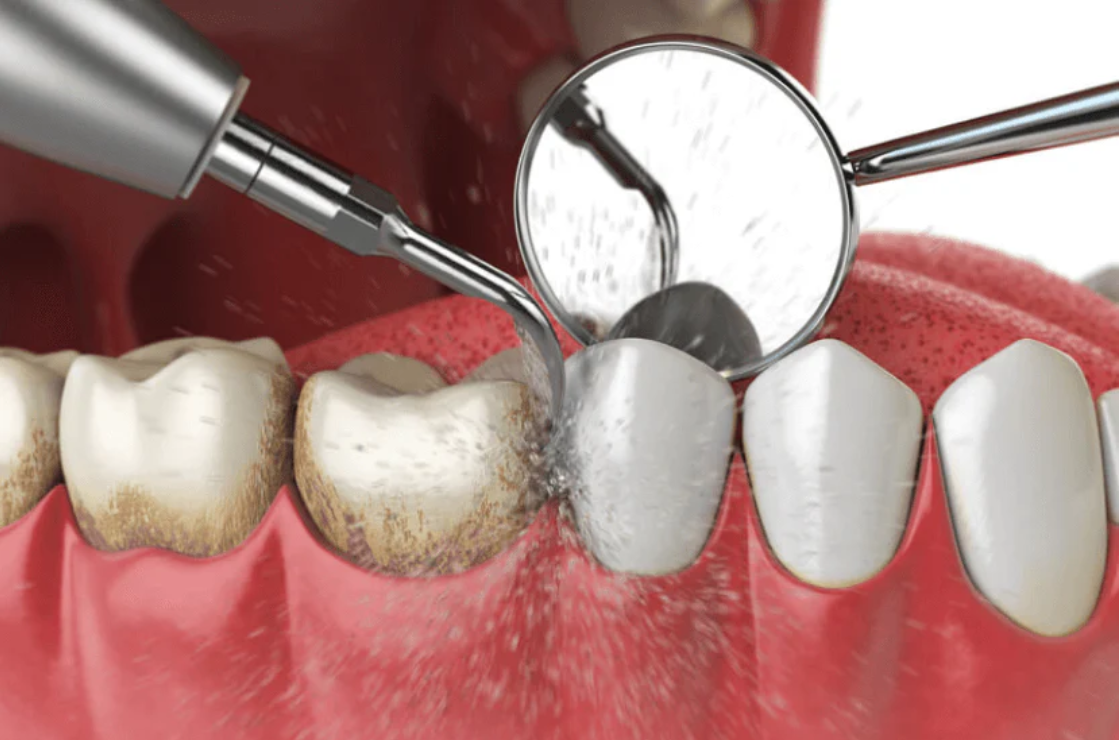 Spark Your Smile with 7 Cosmetic Dentistry Wonders