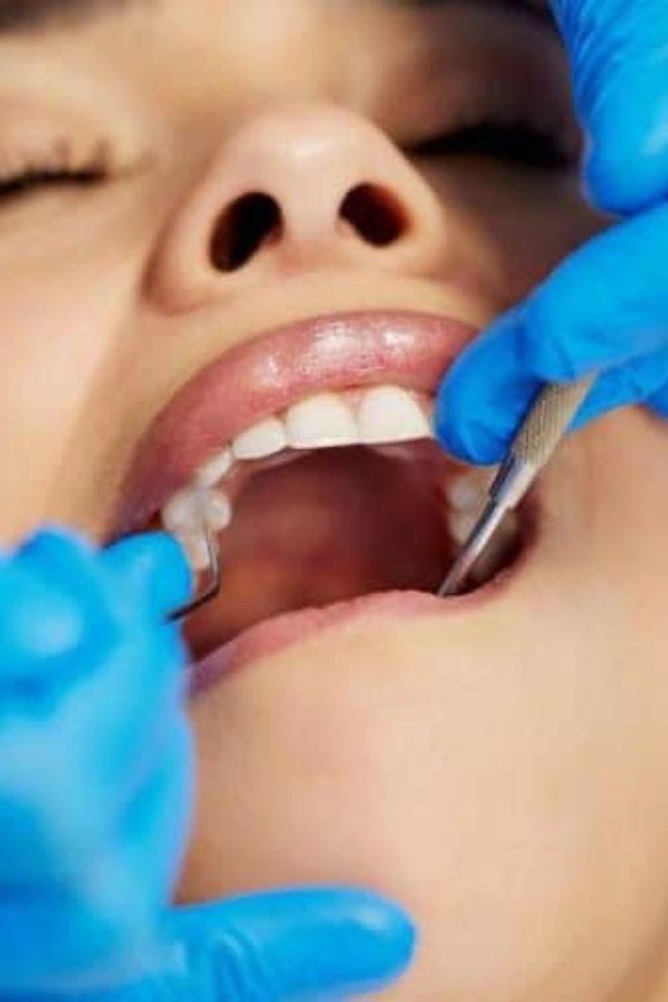 Modern Root Canal Treatment: Safe, Effective & Painless